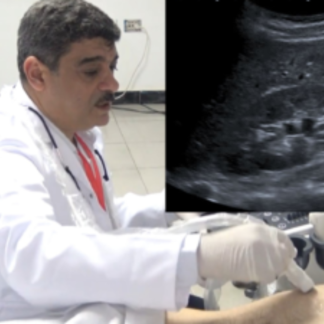 Abdominal & Pelvic Ultrasound