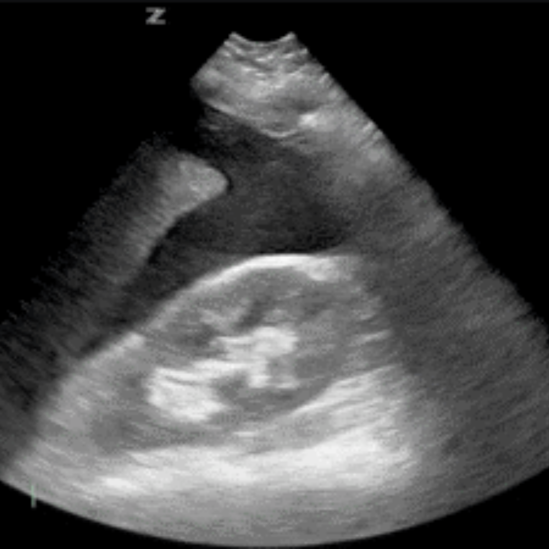 POCUS – FAST & EFAST | English Version