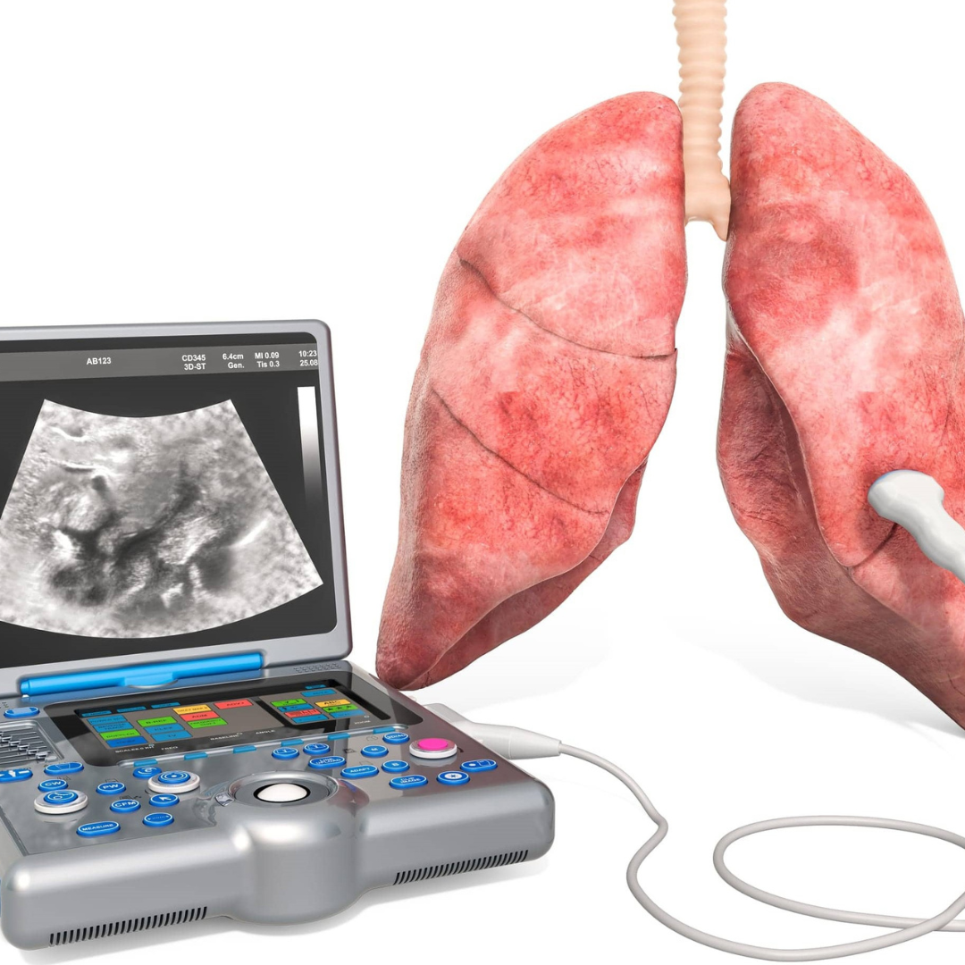 Understanding Lung Ultrasound | Arabic Version