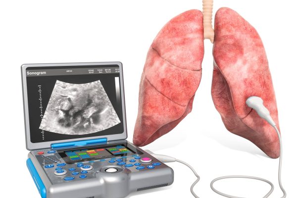 Lung-ultrasound